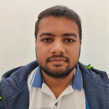 After Hair Transplant - Our Real patient from Udaipur, Rajasthan