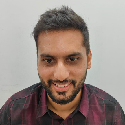 After Hair Transplant - Our Real patient from Udaipur