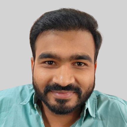 After Hair Transplant - Our Real patient from Udaipur